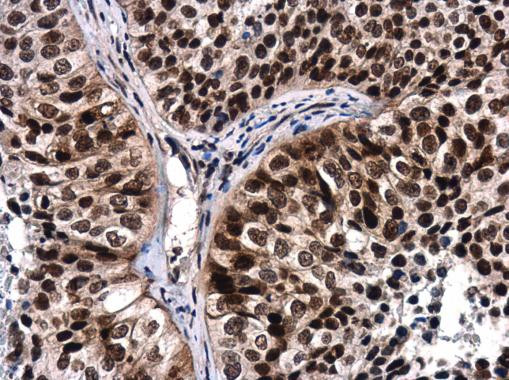 Phospho-ATR (Thr1989) Antibody in Immunohistochemistry (Paraffin) (IHC (P))