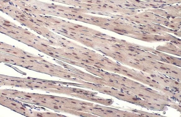 Phospho-ATR (Thr1989) Antibody in Immunohistochemistry (Paraffin) (IHC (P))