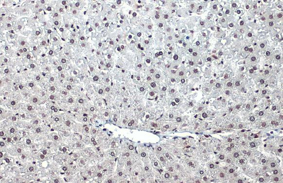 Phospho-ATR (Thr1989) Antibody in Immunohistochemistry (Paraffin) (IHC (P))