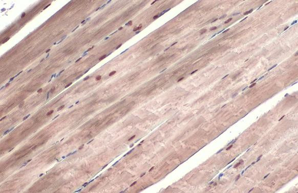 Phospho-ATR (Thr1989) Antibody in Immunohistochemistry (Paraffin) (IHC (P))