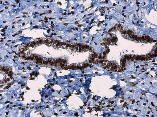 Phospho-ATR (Thr1989) Antibody in Immunohistochemistry (Paraffin) (IHC (P))