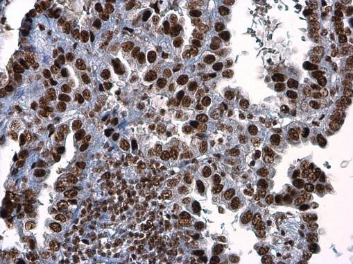 Phospho-ATR (Thr1989) Antibody in Immunohistochemistry (Paraffin) (IHC (P))