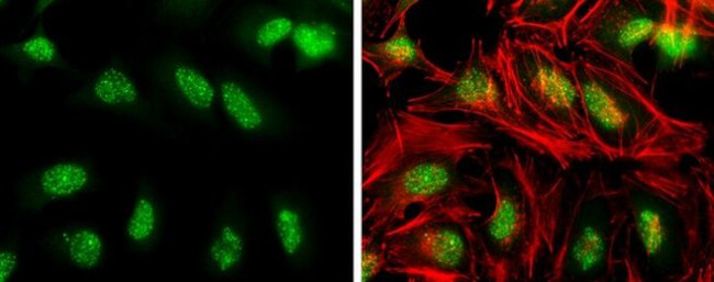 Phospho-ATR (Thr1989) Antibody in Immunocytochemistry (ICC/IF)