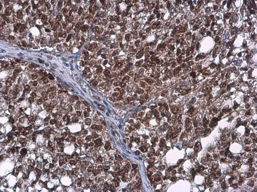 Phospho-ATR (Thr1989) Antibody in Immunohistochemistry (Paraffin) (IHC (P))