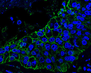 Axl Antibody in Immunohistochemistry (Paraffin) (IHC (P))