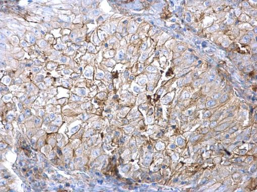 Axl Antibody in Immunohistochemistry (Paraffin) (IHC (P))