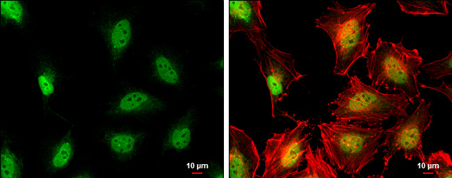 Blooms Syndrome Antibody in Immunocytochemistry (ICC/IF)