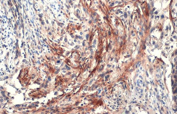 Carbonic Anhydrase IX Antibody in Immunohistochemistry (Paraffin) (IHC (P))