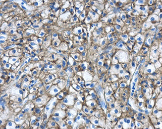 Carbonic Anhydrase IX Antibody in Immunohistochemistry (Paraffin) (IHC (P))