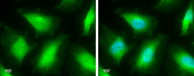 Caspase 8 Antibody in Immunocytochemistry (ICC/IF)