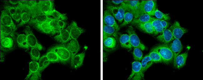 CDK1 Antibody in Immunocytochemistry (ICC/IF)