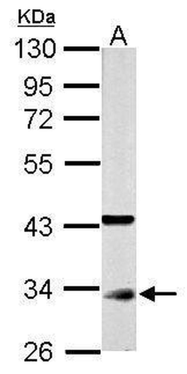 CDK1 Antibody in Western Blot (WB)