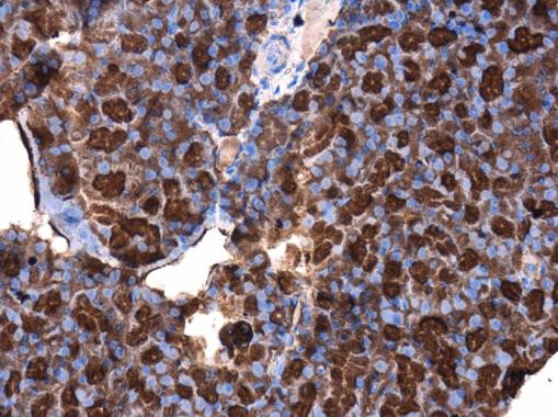 Cdc25A Antibody in Immunohistochemistry (Paraffin) (IHC (P))