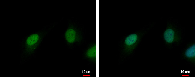 CDK6 Antibody in Immunocytochemistry (ICC/IF)