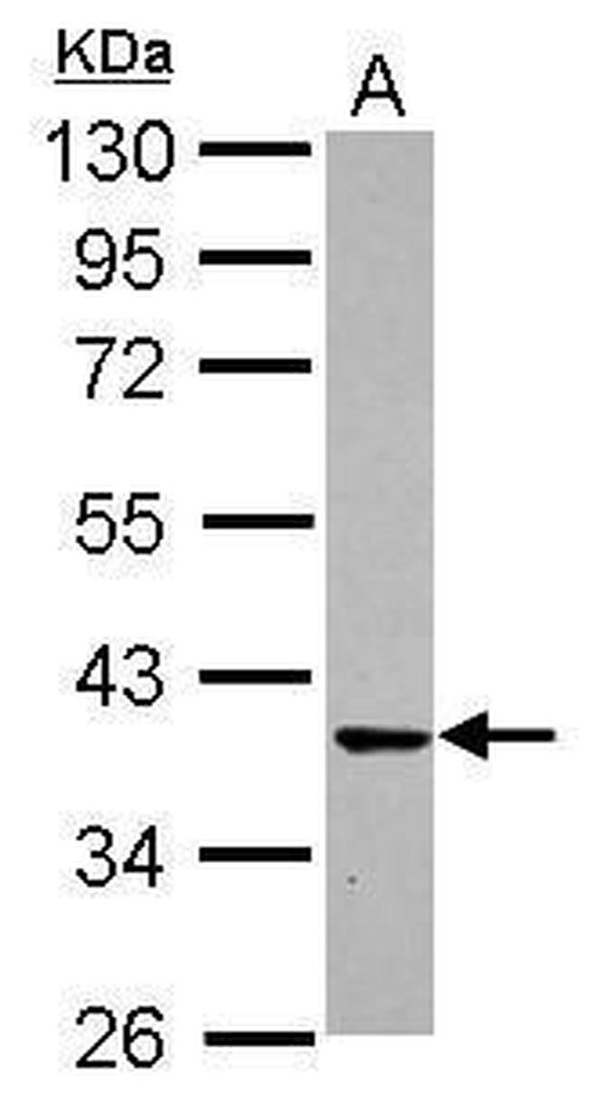 CDK6 Antibody in Western Blot (WB)