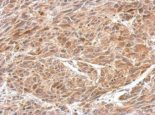 CRMP1 Antibody in Immunohistochemistry (Paraffin) (IHC (P))