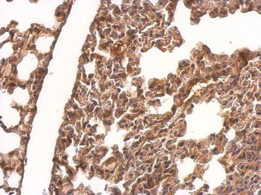 CRMP1 Antibody in Immunohistochemistry (Paraffin) (IHC (P))