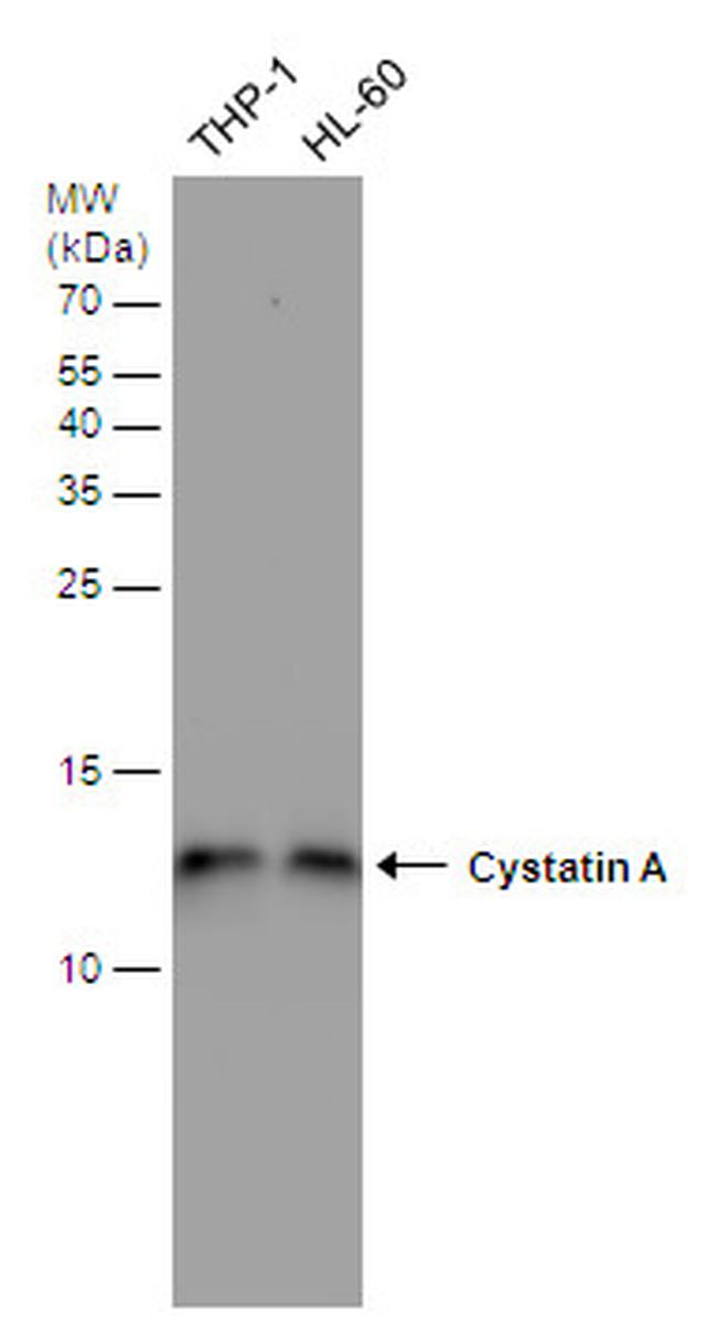 Cystatin A Antibody in Western Blot (WB)