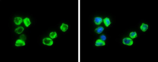 Cystatin A Antibody in Immunocytochemistry (ICC/IF)