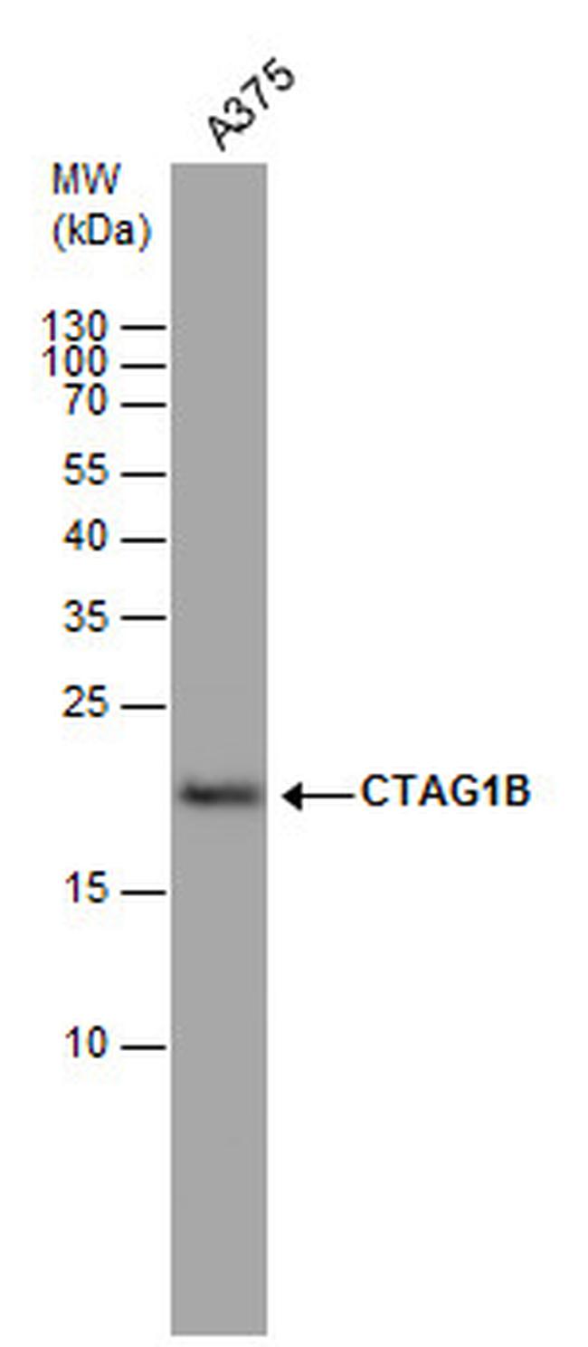 CTAG1B Antibody in Western Blot (WB)