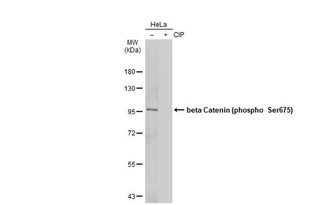 Phospho-beta Catenin (Ser675) Antibody in Western Blot (WB)
