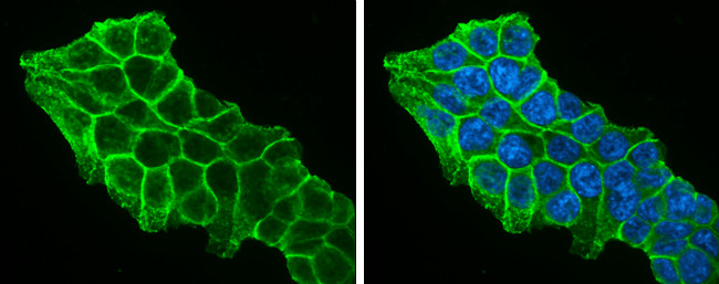 beta Catenin Antibody in Immunocytochemistry (ICC/IF)