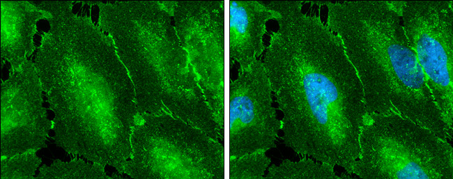 beta Catenin Antibody in Immunocytochemistry (ICC/IF)