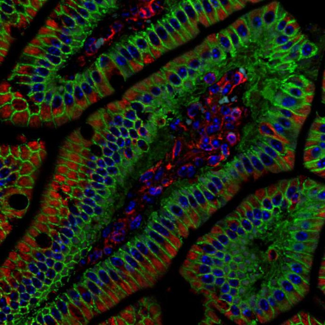 beta Catenin Antibody in Immunohistochemistry (Paraffin) (IHC (P))