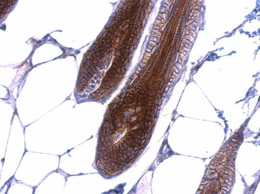 beta Catenin Antibody in Immunohistochemistry (Paraffin) (IHC (P))