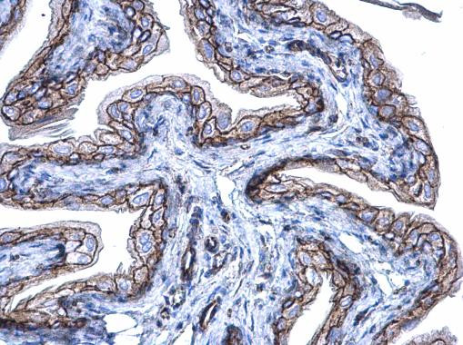 beta Catenin Antibody in Immunohistochemistry (Paraffin) (IHC (P))