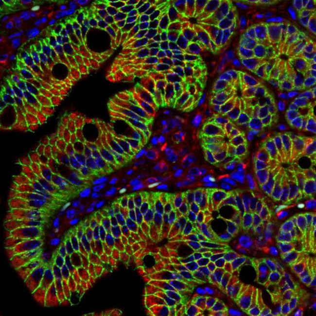 beta Catenin Antibody in Immunohistochemistry (Paraffin) (IHC (P))