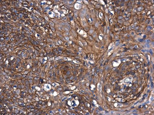 beta Catenin Antibody in Immunohistochemistry (Paraffin) (IHC (P))