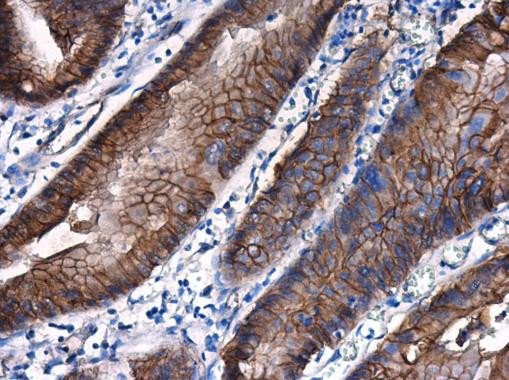 beta Catenin Antibody in Immunohistochemistry (Paraffin) (IHC (P))