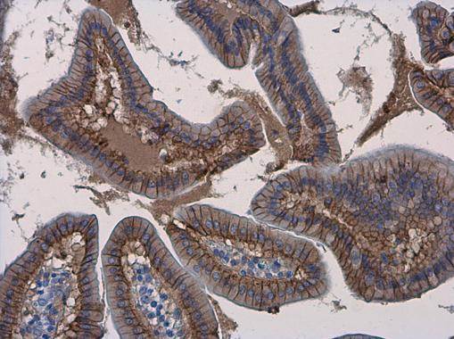 beta Catenin Antibody in Immunohistochemistry (Paraffin) (IHC (P))