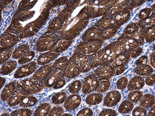 beta Catenin Antibody in Immunohistochemistry (Paraffin) (IHC (P))