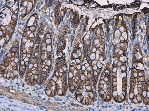 beta Catenin Antibody in Immunohistochemistry (Paraffin) (IHC (P))