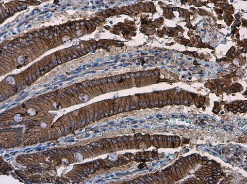 beta Catenin Antibody in Immunohistochemistry (Paraffin) (IHC (P))