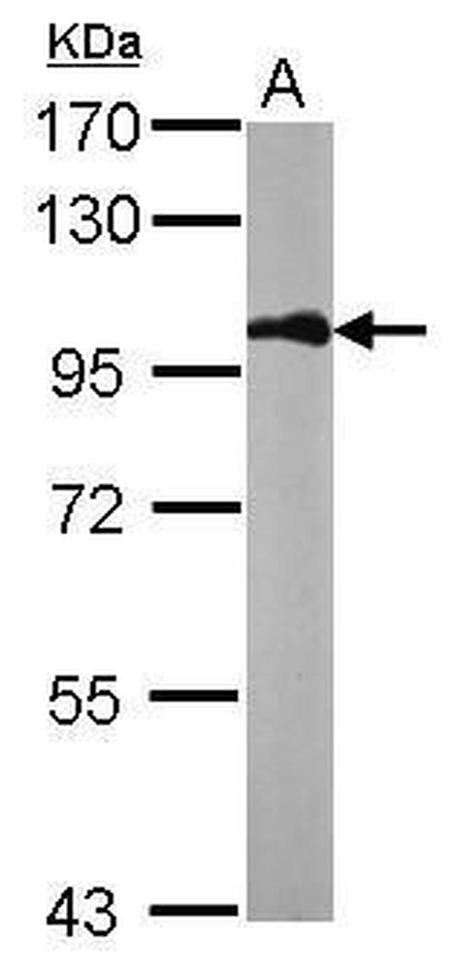 beta Catenin Antibody in Western Blot (WB)