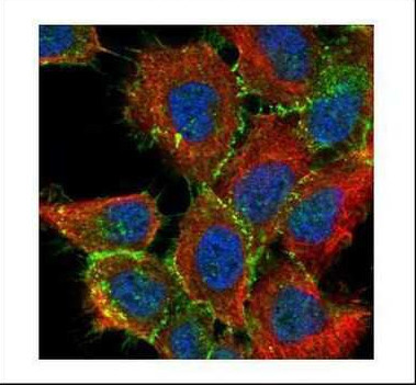 beta Catenin Antibody in Immunocytochemistry (ICC/IF)