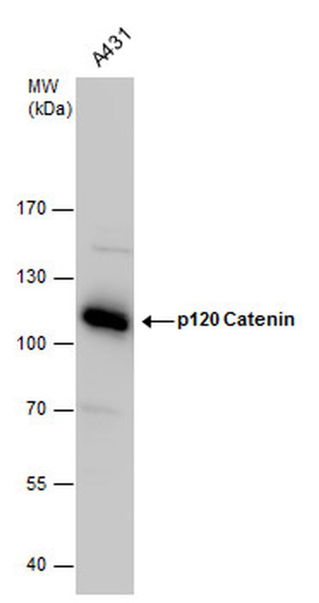 delta Catenin Antibody in Western Blot (WB)