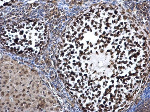 DNMT3A Antibody in Immunohistochemistry (Paraffin) (IHC (P))