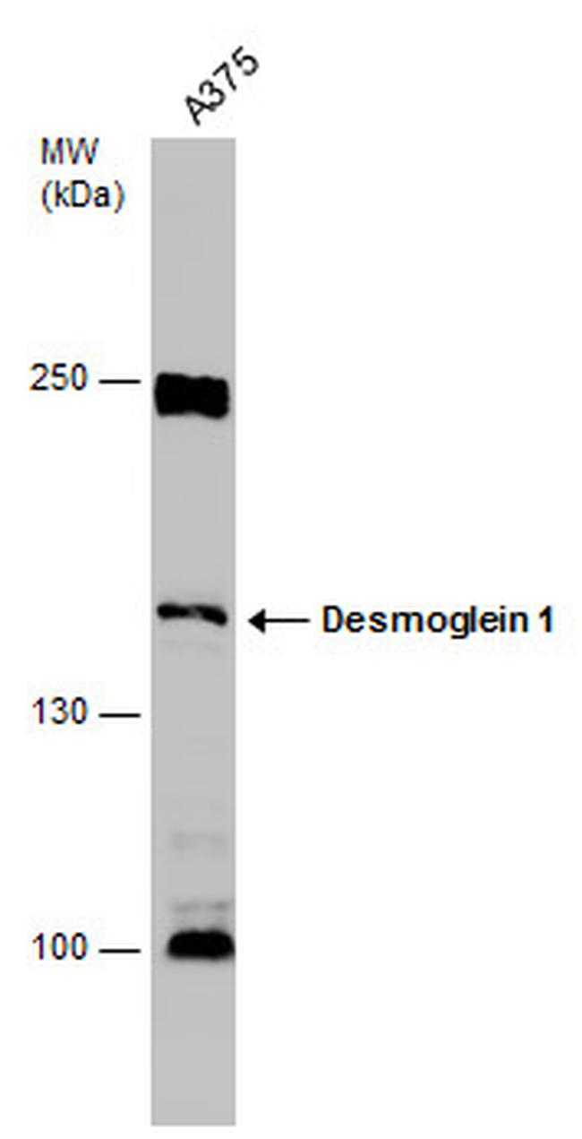 Desmoglein 1 Antibody in Western Blot (WB)