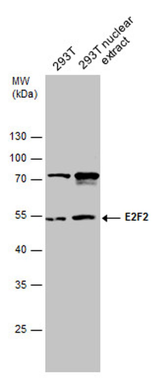 E2F2 Antibody in Western Blot (WB)