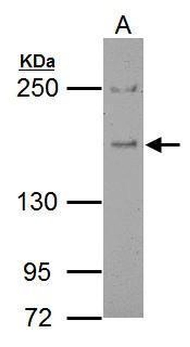 EPS15 Antibody in Western Blot (WB)