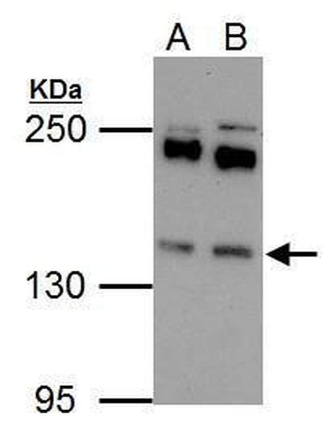 EPS15 Antibody in Western Blot (WB)