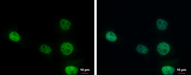 ERCC1 Antibody in Immunocytochemistry (ICC/IF)