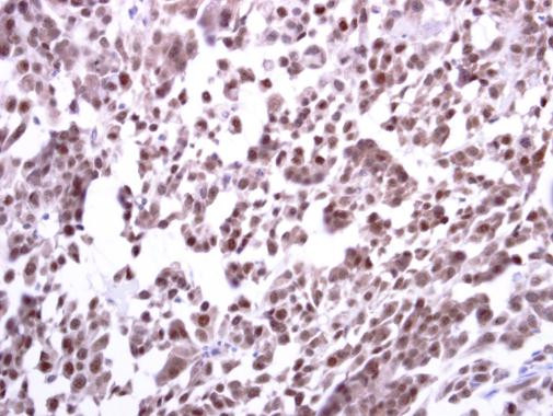 ERCC1 Antibody in Immunohistochemistry (Paraffin) (IHC (P))