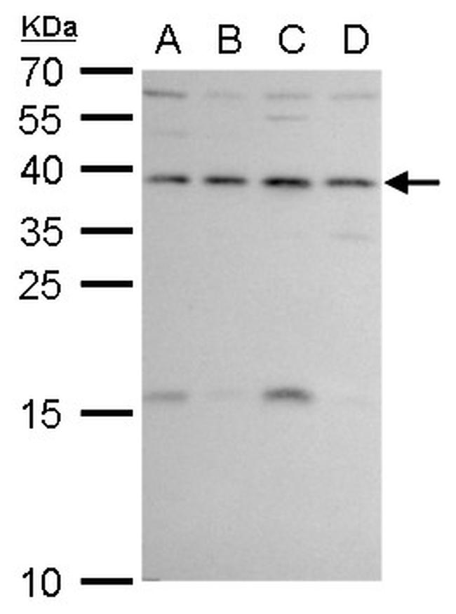 ERCC1 Antibody in Western Blot (WB)