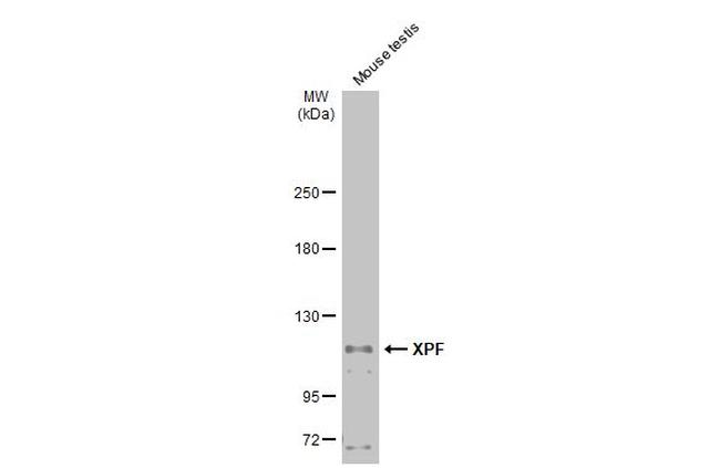 XPF Antibody in Western Blot (WB)