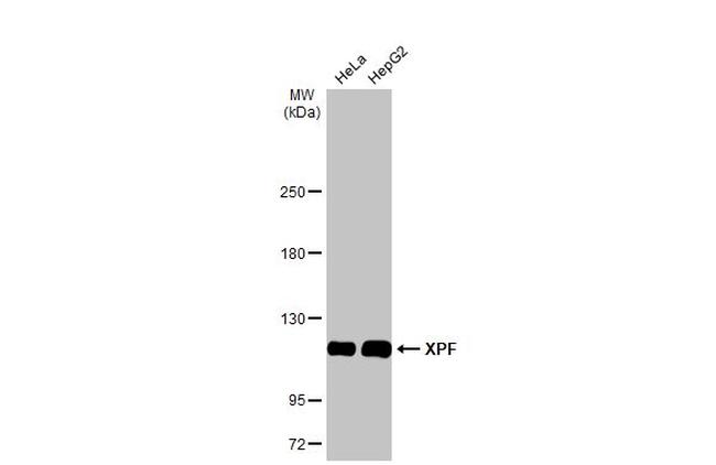 XPF Antibody in Western Blot (WB)